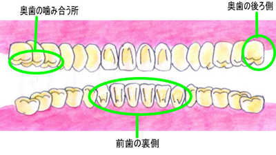 歯を裏側から見ると・・・・・